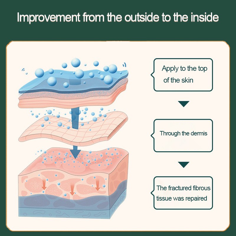 Fungal Infection Cream Manufacturer - Free Sample Itching Ointment Eczema