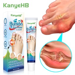 Joint Pain Ointment Manufacturer - Toe Valgus Hand Wrist