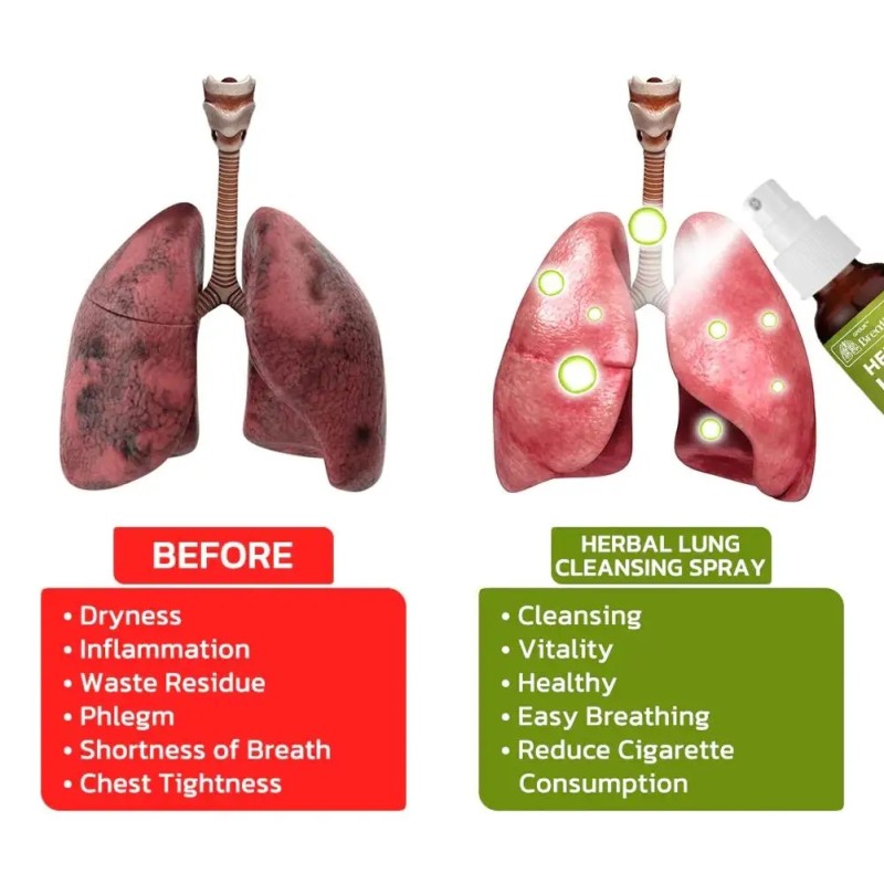 Lung Cleansing Spray Manufacturer - Herbal Breath Detox Mist