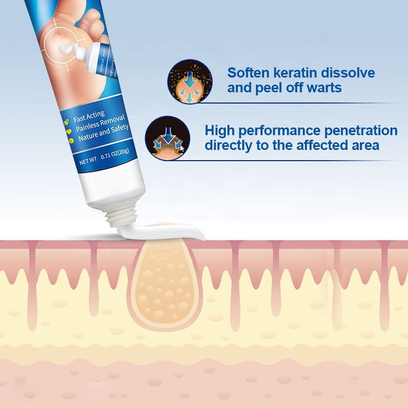 Wart Cream Manufacturer - Cleansing Sterilization External