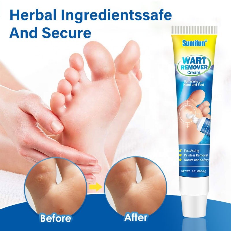 Wart Cream Manufacturer - Cleansing Sterilization External