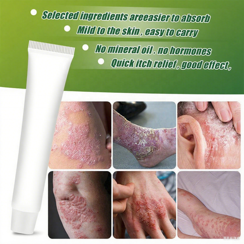 Antifungal Cream Factory - OEM Herbal Itch Relief Tea Tree