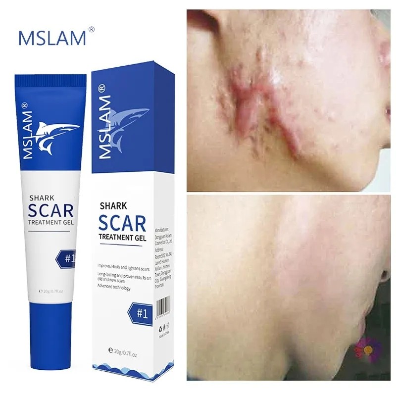 Scar Removal Cream Factory - Acne Spots Burn Repair