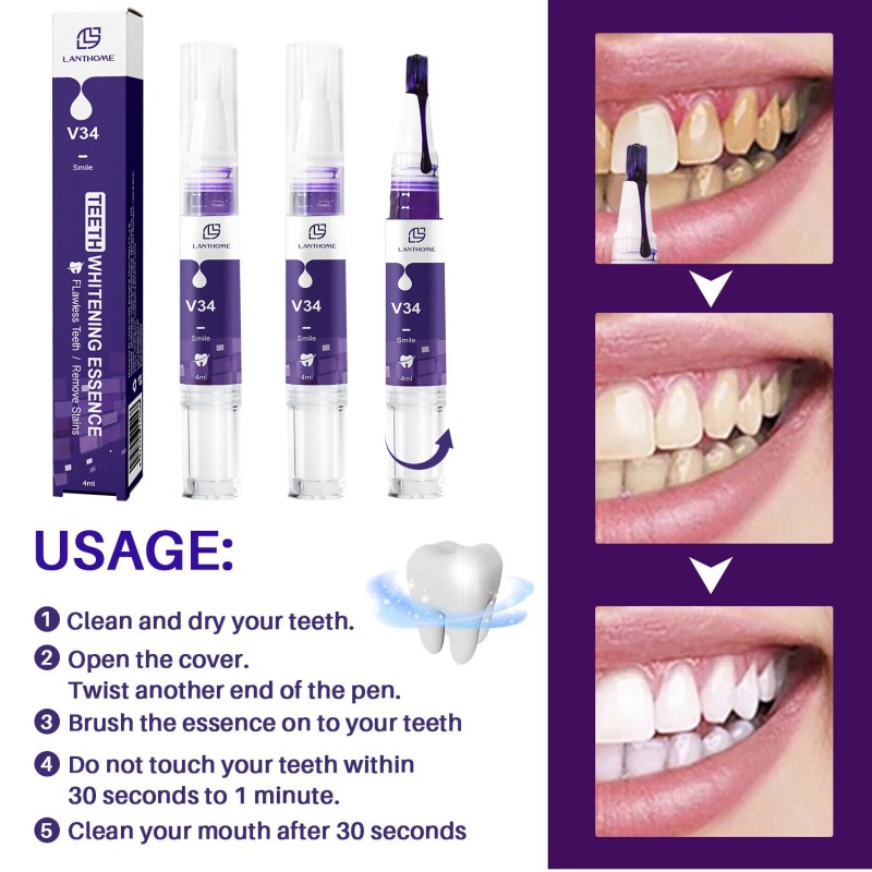 Whitening Toothpaste Supplier - V34 Smilekit Yellowing Removal