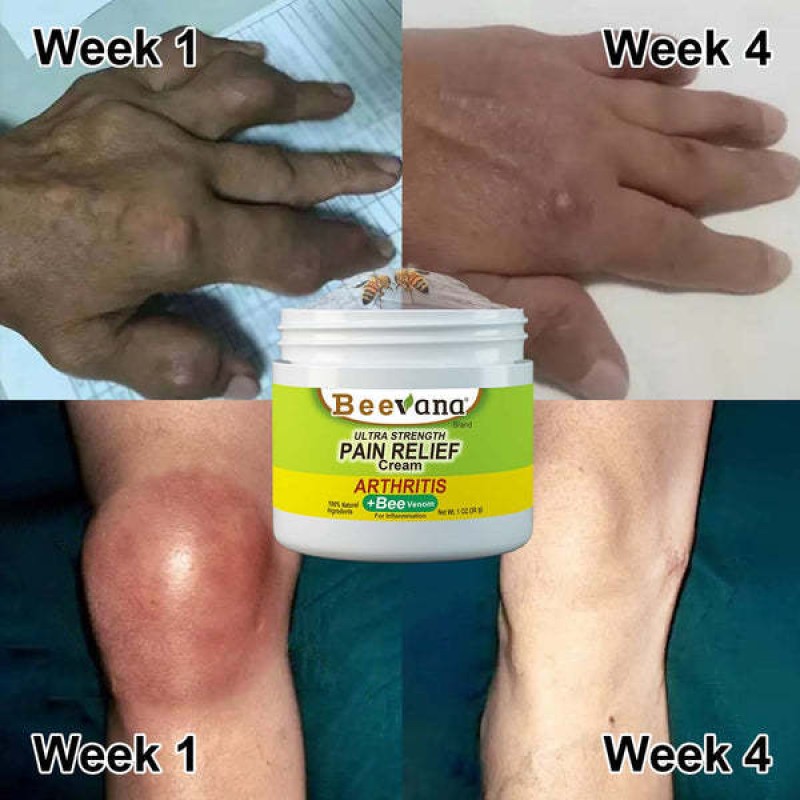 Joint Bone Cream Supplier - Beevana Arthritis Gel Care