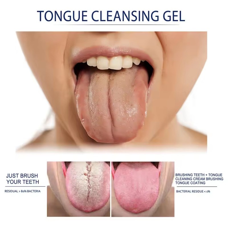 Tongue Scraper Factory - Gel Cleaning Bad Breath Fighter