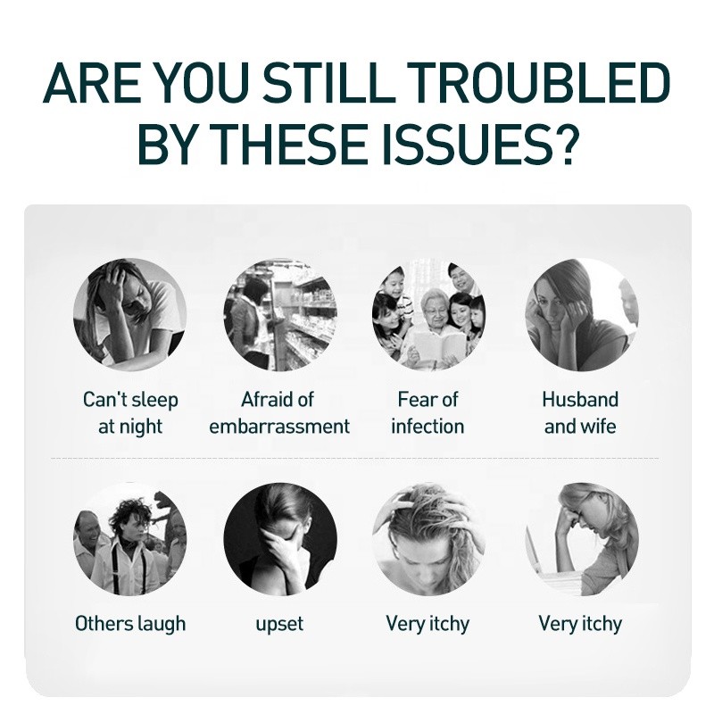 Lice Spray Supplier - 30ml Killing Anti-itch Repellent