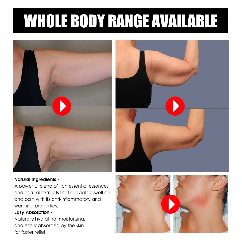 Lymphatic Detox Ointment Supplier - Massage Anti-swelling Herbs