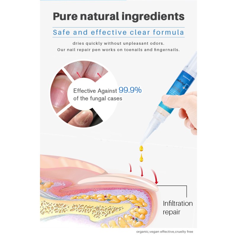Nail Care Pen Manufacturer - Fungus Wear Repair Solution