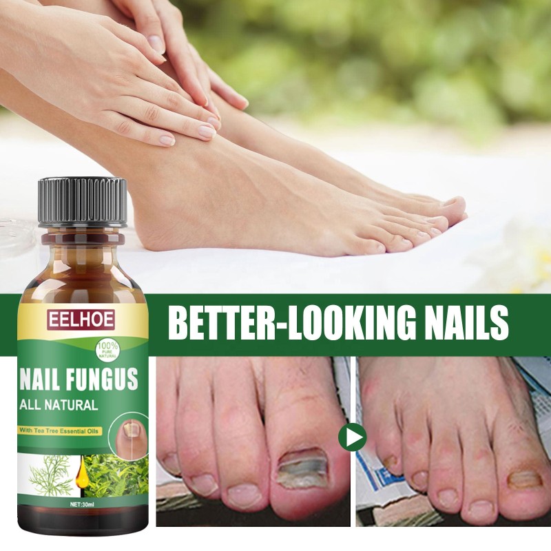 Toenail Solution Manufacturer - Tea Tree Fungus Sterilization