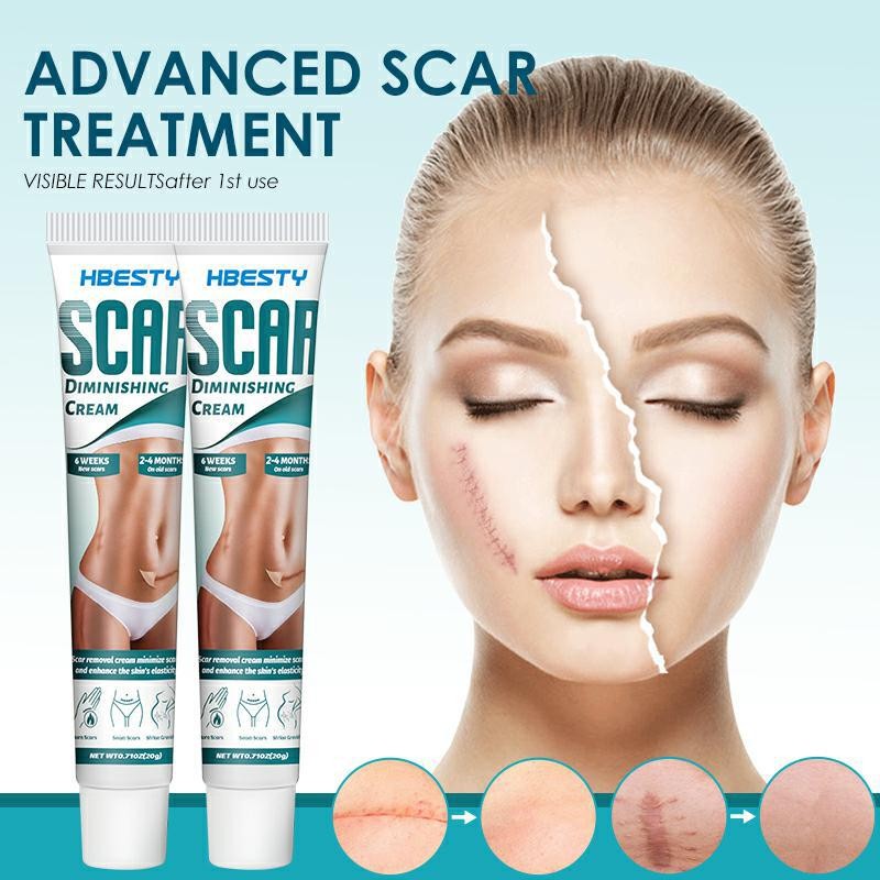 Acne Cream Manufacturer - Surgical Stretch Marks Repair