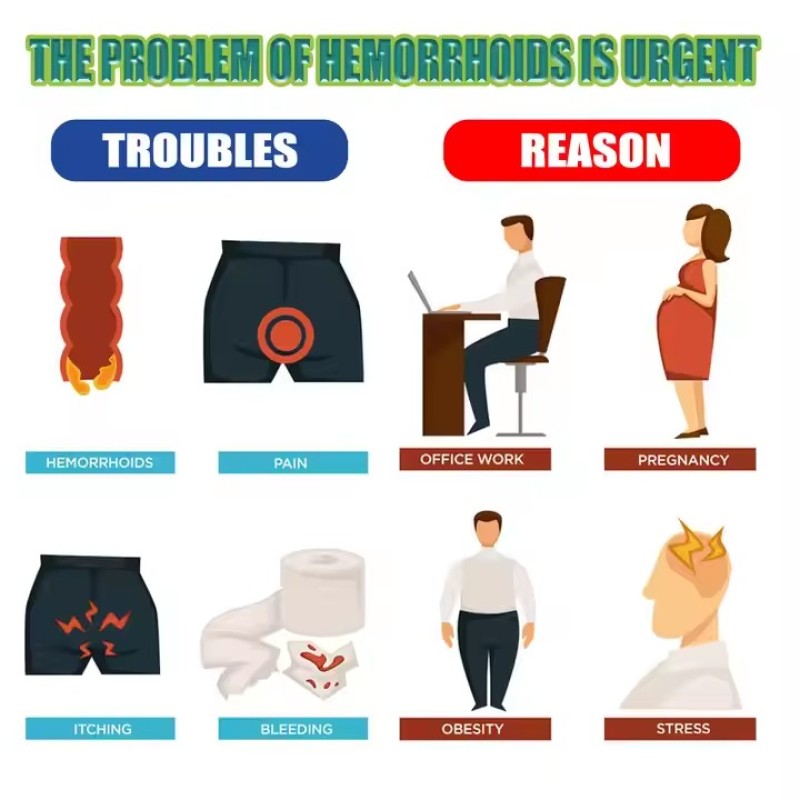 Hemorrhoids Capsules Factory - Herbal Anal Fissure Pain