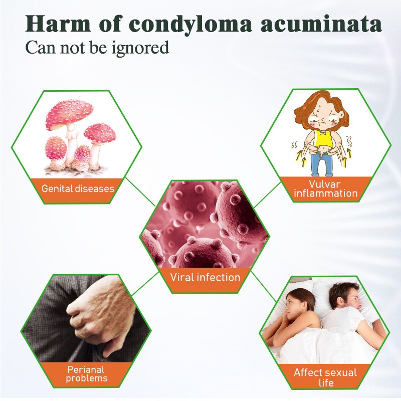 Genital Wart Cream Manufacturer - Papillomas Removal Ointment