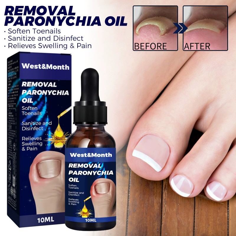 Nail Repair Oil Manufacturer - Hand Foot Moisturizing Care