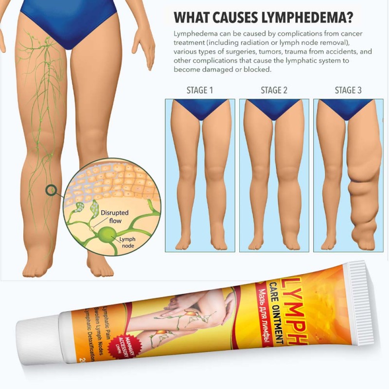Lymphatic Detox Cream Supplier - Neck Armpit Swelling Pain