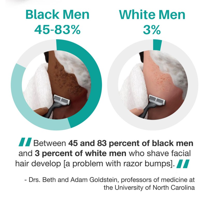 Hair Removal Oil Supplier - Prevents Ingrown Moisturizing