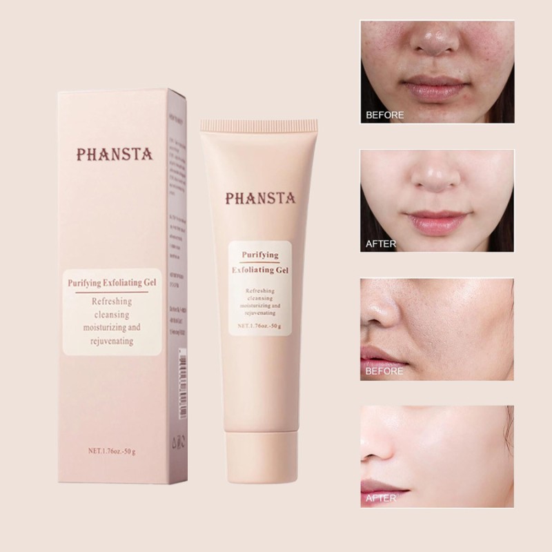 Moisturizing Cream Supplier - Pore Removing Face Cream