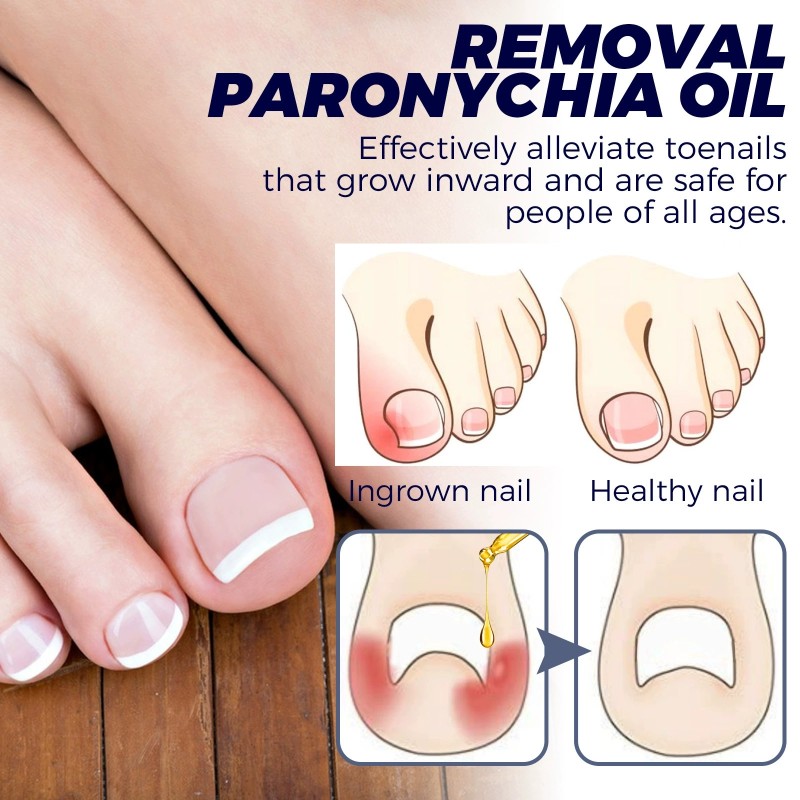 Nail Repair Oil Manufacturer - Hand Foot Moisturizing Care