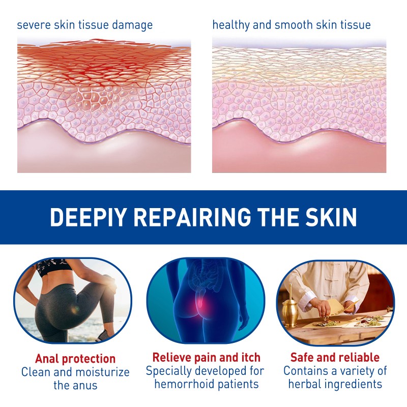 Hemorrhoids Capsules Supplier - OEM Internal External Relief