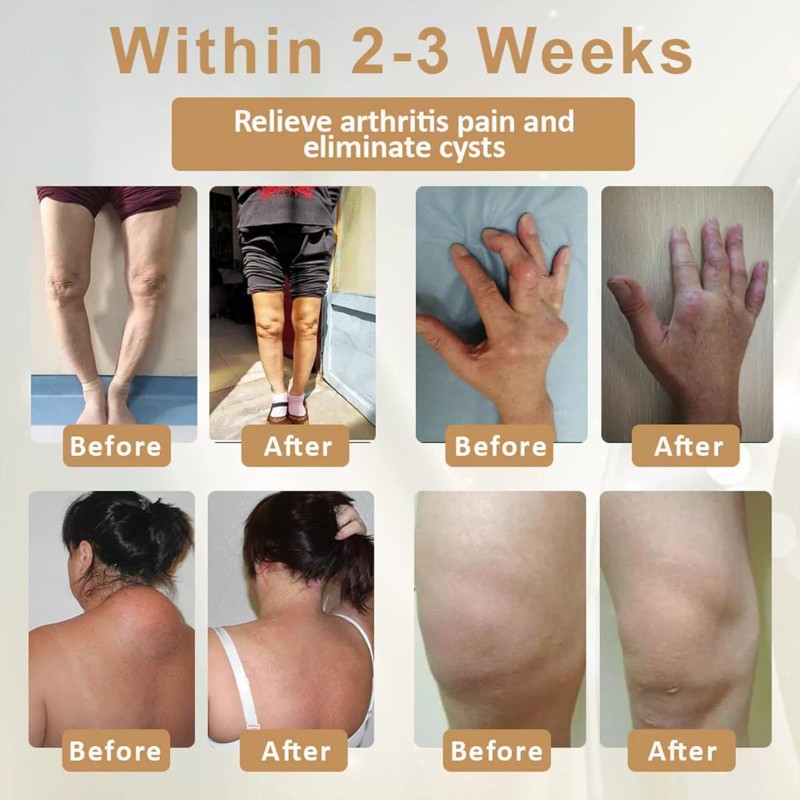 Joint Gel Manufacturer - Turmeric Emu Oil Massage Gel