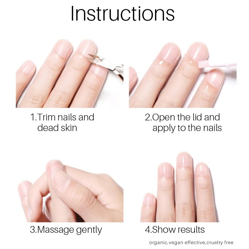 Nail Care Pen Manufacturer - Fungus Wear Repair Solution