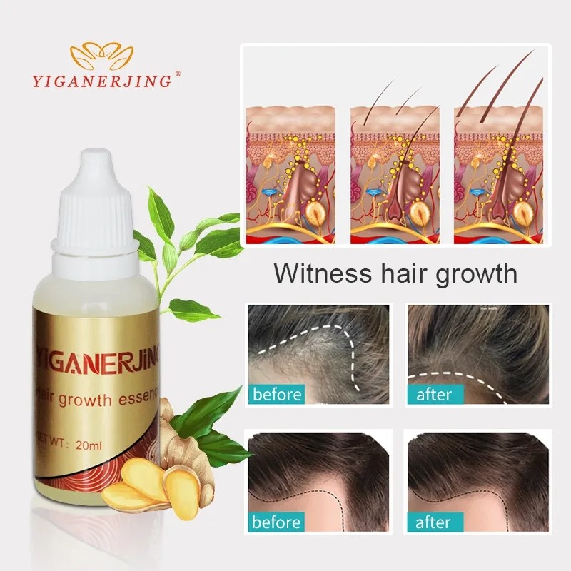 Hair Growth Oil Factory - Ginger Regrowth Treatment Serum