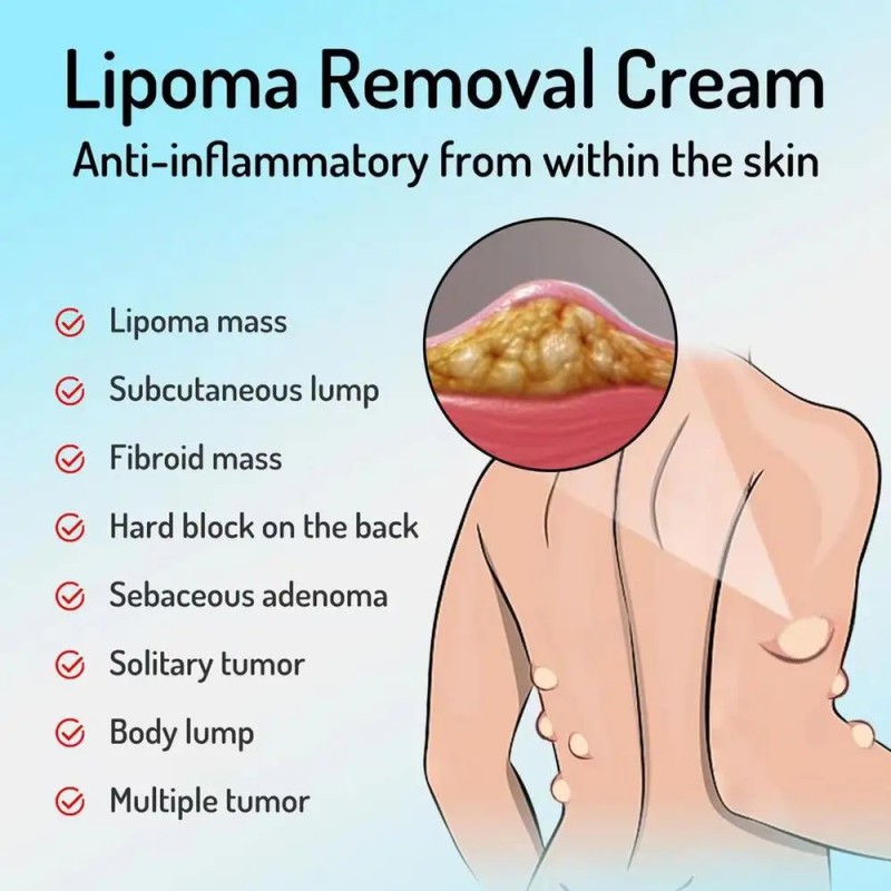 Lipoma Cream Supplier - Portable Skin Care Lotion