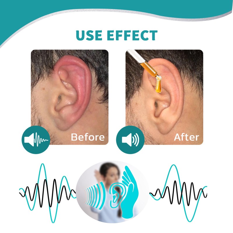 Tinnitus Oil Manufacturer - Ear Ringing Itching Health Care