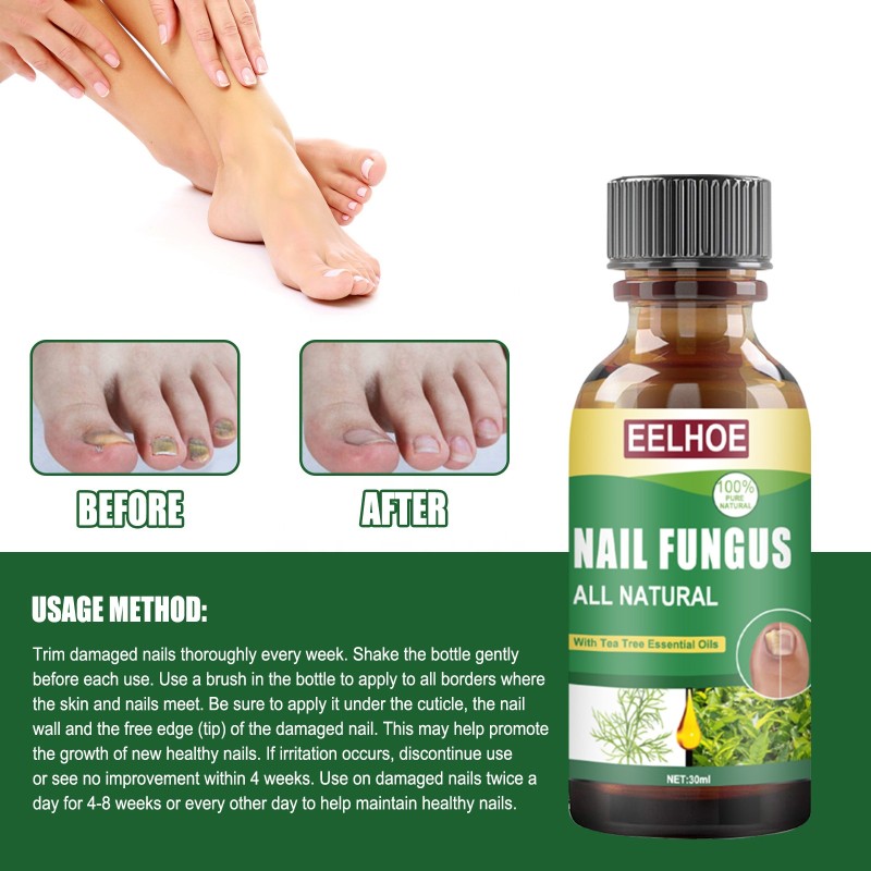 Toenail Solution Manufacturer - Tea Tree Fungus Sterilization
