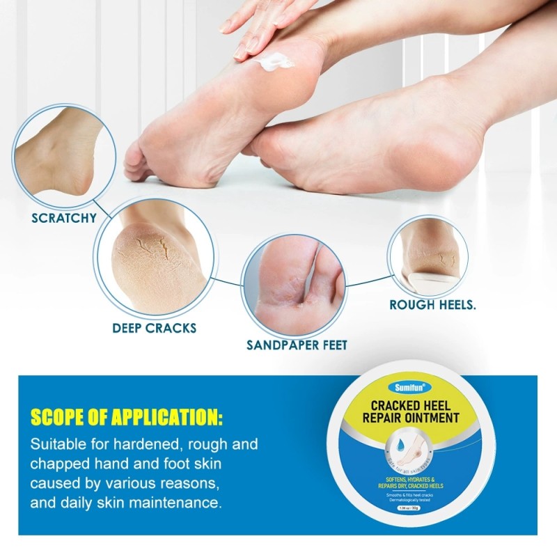 Foot Repair Cream Supplier - Herbal Cracked Heel Care
