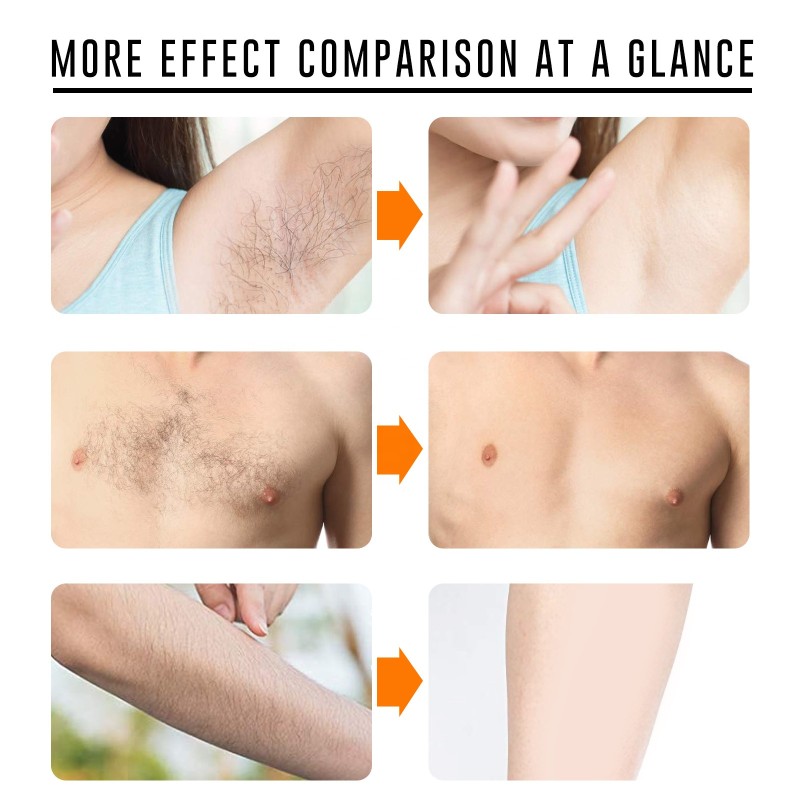 Hair Removal Spray Factory - Unisex Gentle Natural Cleansing