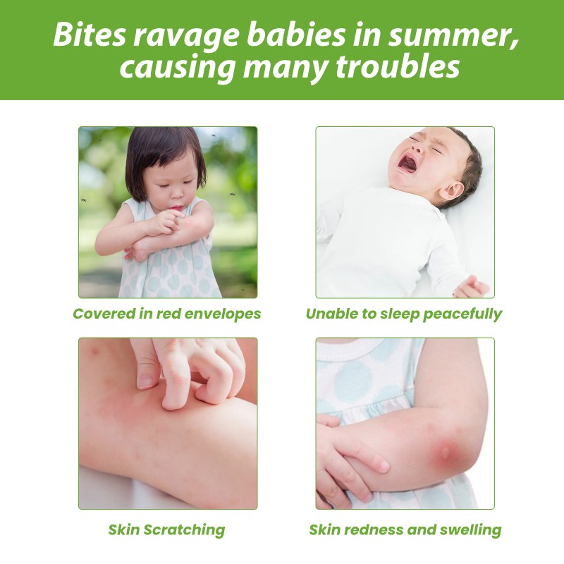 Baby Mosquito Repellent Manufacturer - Private Label Summer Anti Itch