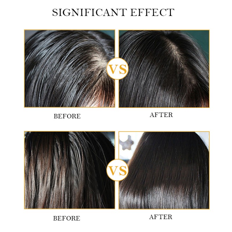 Hair Care Set Factory - OEM Organic Hair Growth Ginger Shampoo