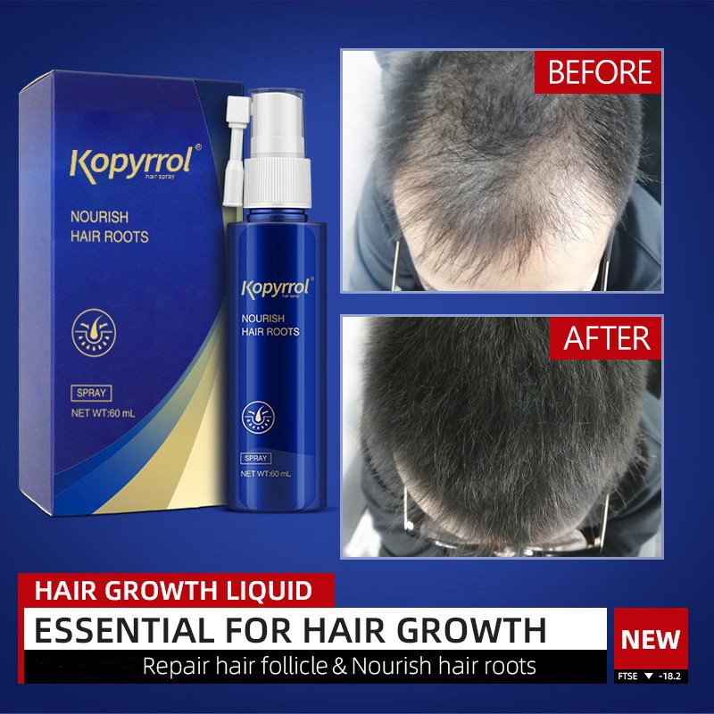 Hair Growth Oil Factory - Private Label New 60ml Loss Treatment