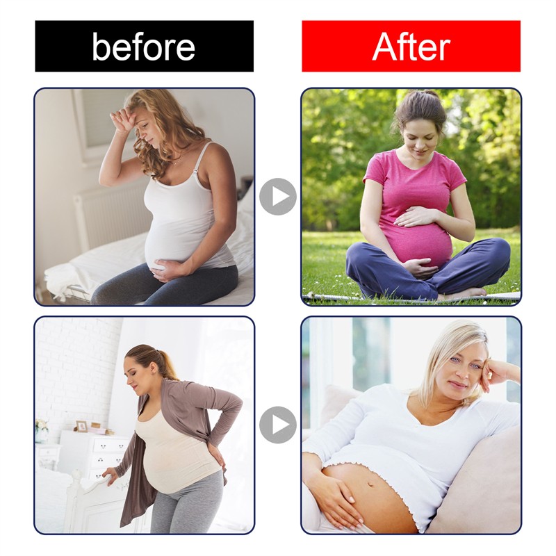 Freckle Cream Factory - Effective Melanin Remover Brightening