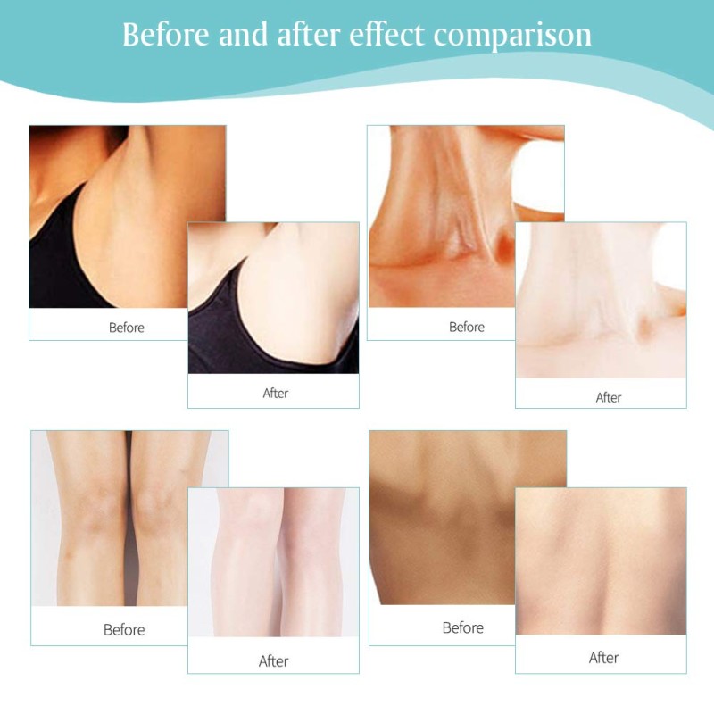 Intimate Whitening Manufacturer - Vaginal Lips Underarm Care