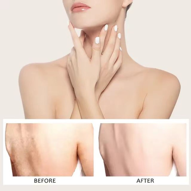 Whitening Lotion Factory - OEM Strong Bikini Area Black Removal