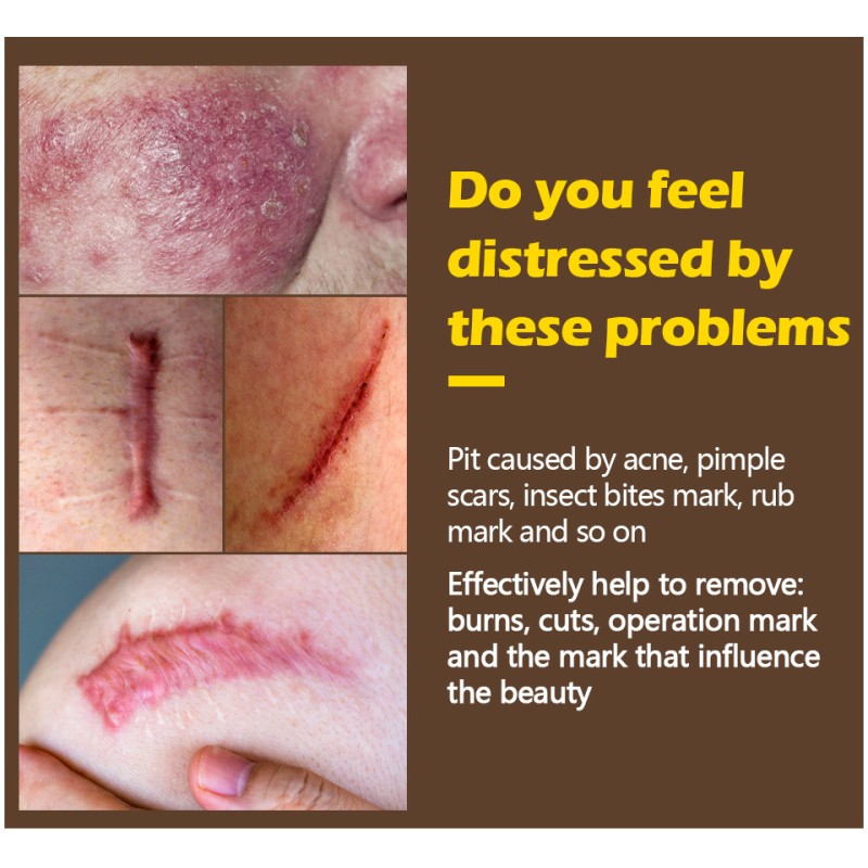 Whitening Cream Manufacturer - Private Label Inner Thigh Lightening