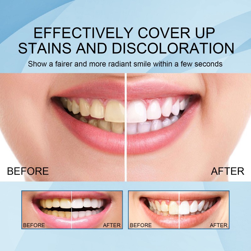 Teeth Whitening Pen Factory - Professional Gel Pen