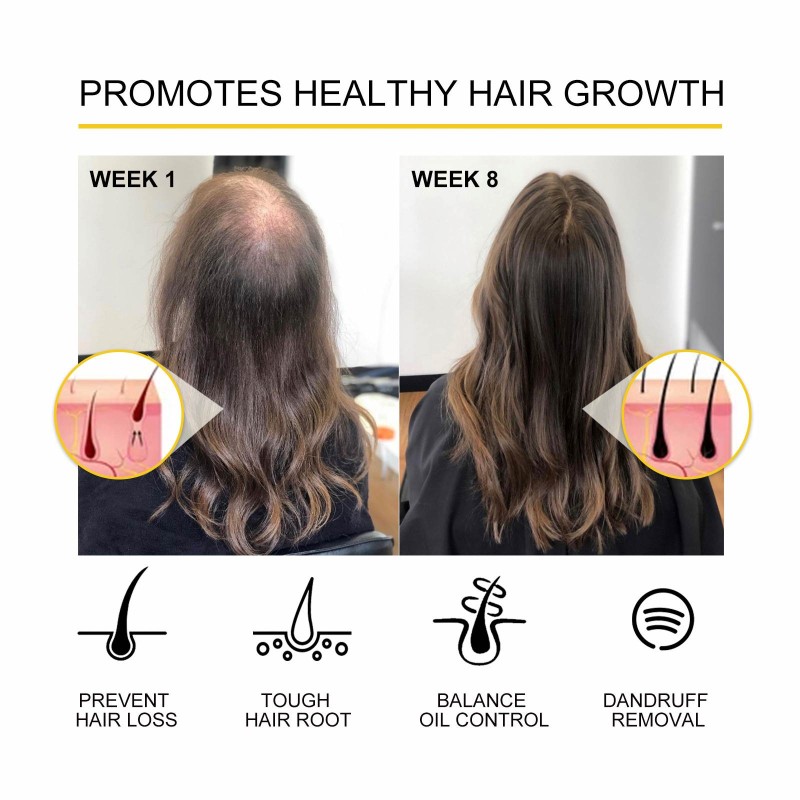 Hair Growth Oil Manufacturer - OUHOE Private Label Density Essential