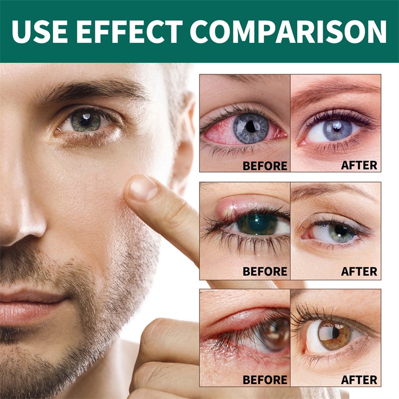 Eyeshadow Palette Manufacturer - OEM Private Label Vegan Custom