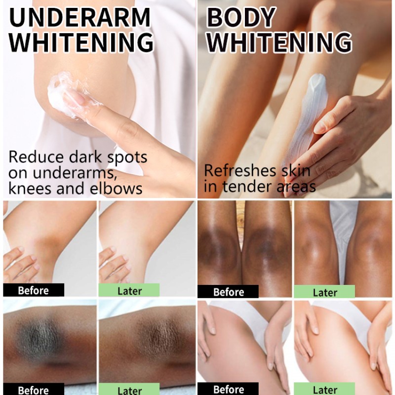 Intimate Whitening Manufacturer - Vaginal Lips Underarm Care