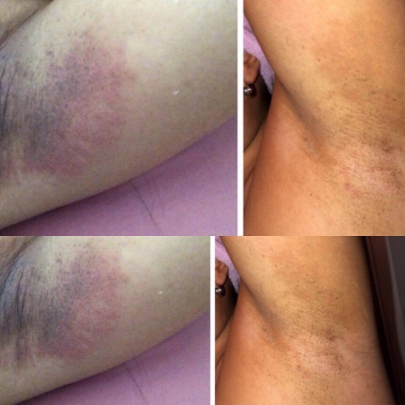 Whitening Cream Factory - OEM 7 Days Private Parts Strongest