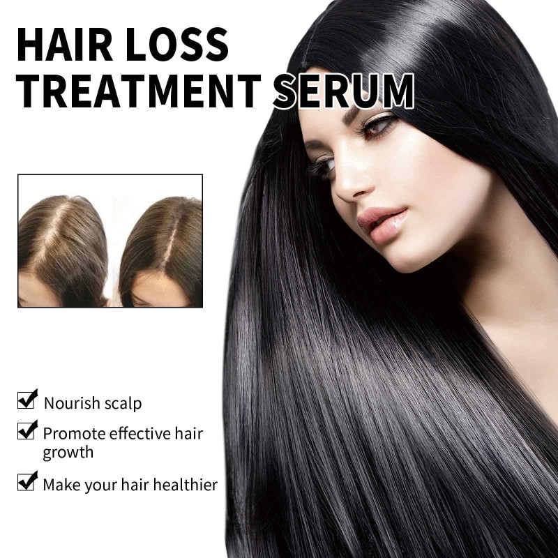Hair Growth Oil Manufacturer - Hot Selling Natural Formula Wholesale