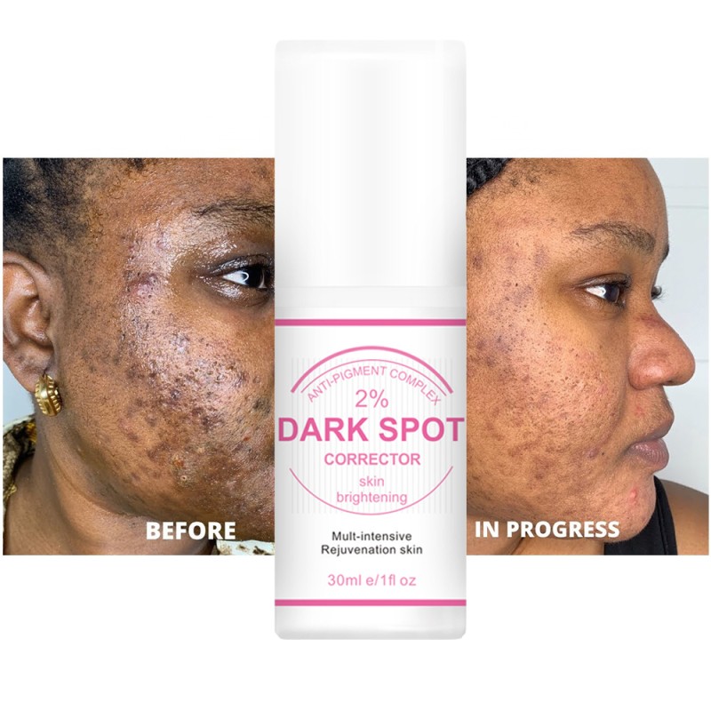 Slimming Cream Factory - Private Label Burn Fat Hot Gel Female