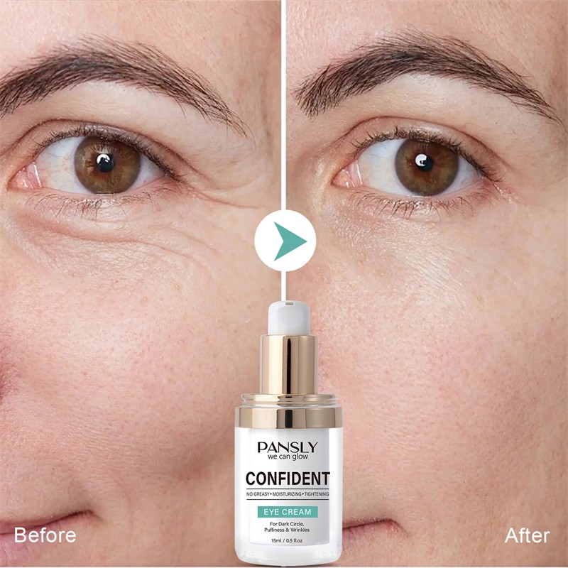 Eye Serum Manufacturer - OEM 30ml Milia Remover Essential