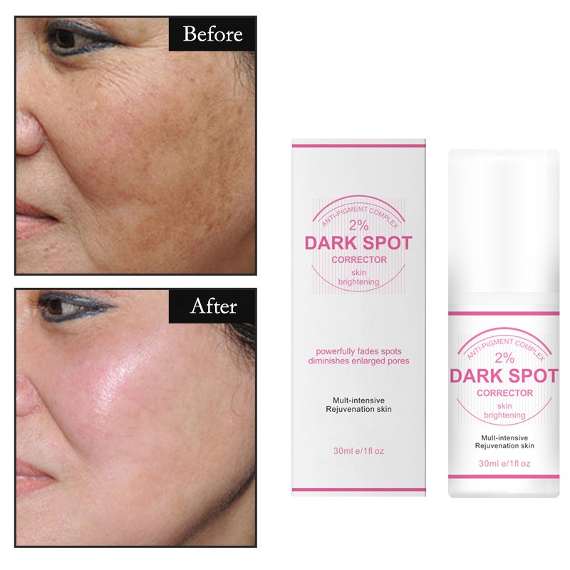 Slimming Cream Factory - Private Label Burn Fat Hot Gel Female