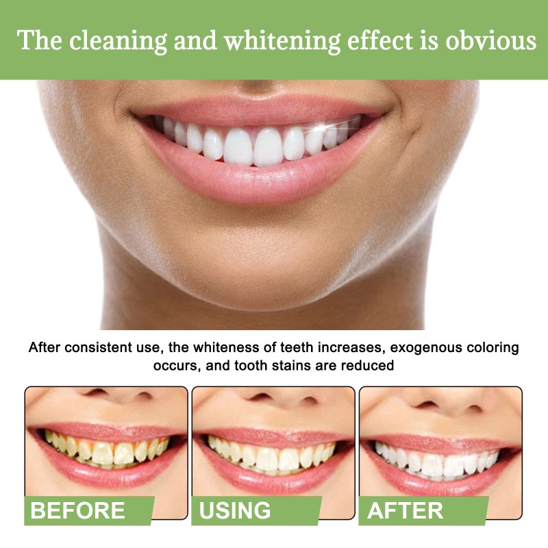 Tooth Whitening Strips Manufacturer - OEM New High Adhesion Day