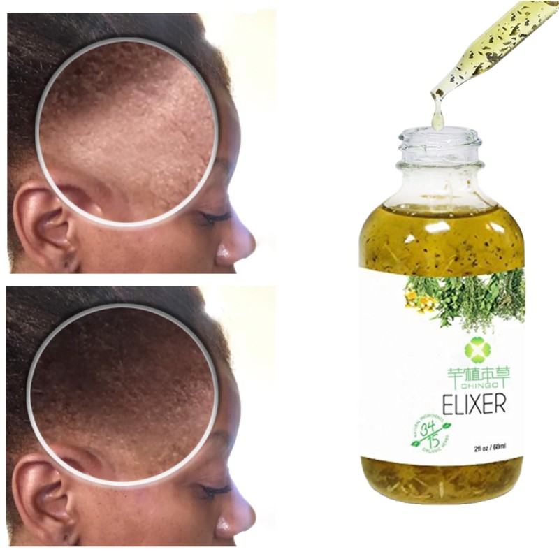 Scalp Elixirs Manufacturer - Custom Logo Organic Formula Wholesale