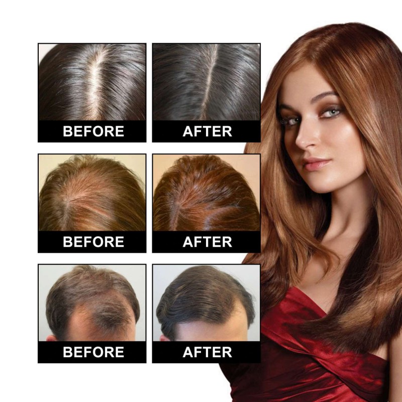 Hair Growth Oil Manufacturer - OUHOE Private Label Density Essential